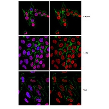 Anti-2,2,7-Trimethylguanosine Antibody, clone K121，100UG，MABE302，Sigma