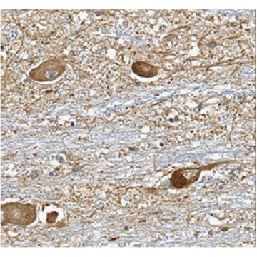 Anti-Versican Antibody, clone 8D8.1，100UG，MABT161，Sigma