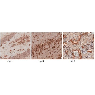 Anti-CYP27B1 Antibody，100UG，ABN182，Sigma