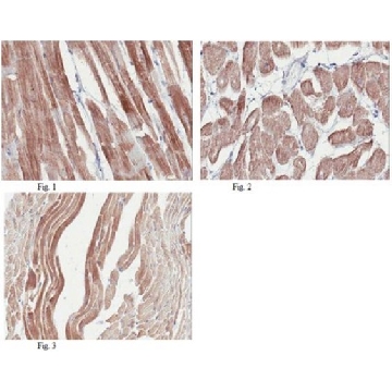 Anti-Titin (NT/Z-domain) Antibody, clone 17D11.1，100UG，MABT75，Sigma