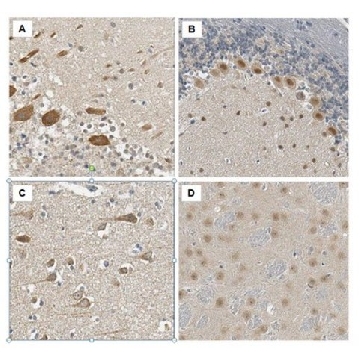 Anti-PRMT8 Antibody，100UG，ABS517，Sigma