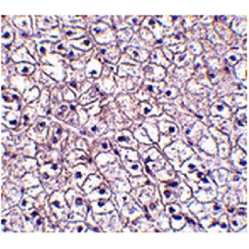 Anti-TSLP receptor Antibody，100UG，ABT334，Sigma