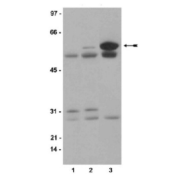 Anti-phospho-Src (Tyr416) Antibody, clone 9A6，5G，5677-5GMCN，Sigma