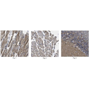 Anti-Pro-neuregulin-1, membrane-bound isoform (NRG1 Antibody)，100UG，ABT179，Sigma