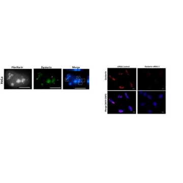 Anti-Dyskerin (Rabbit)，200UL，ABE2587，Sigma