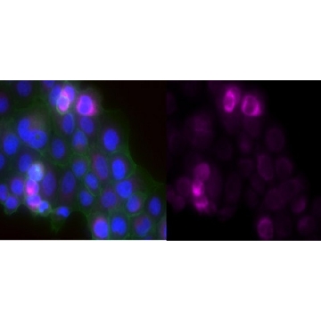 Anti-Laminin-5 Antibody (γ2 chain), clone D4B5, Alexa Fluor™ 647 Conjugate，100UL，MAB19562-AF647，Sigma