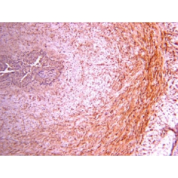 Anti-Procollagen Type III PIIINP Antibody，100UG，AB764P，Sigma