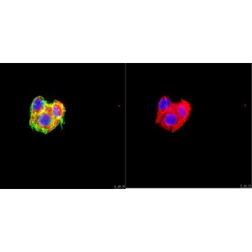 Anti-Cytokeratin 8 Antibody, clone TROMA-1，100UG，MABT329，Sigma