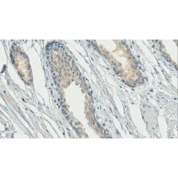 Anti-Gonadotropin-Releasing Hormone Antibody, NT, clone HU11B (Ascites Free)，100UG，MAB5456-C，Sigma