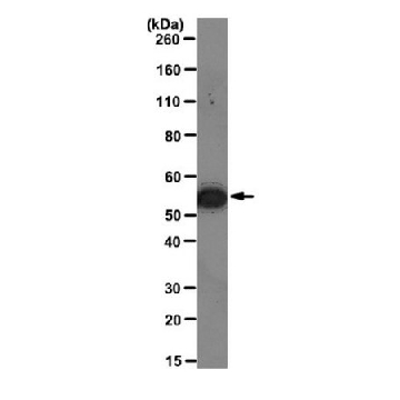Anti-Vimentin Antibody, clone 3CB2，100UL，MABT121，Sigma