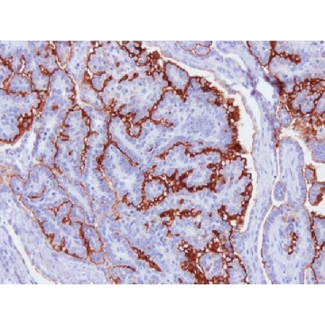 Anti-Mucin-16 (CA-125) Antibody, clone 5E11，100UG，MABC1608，Sigma