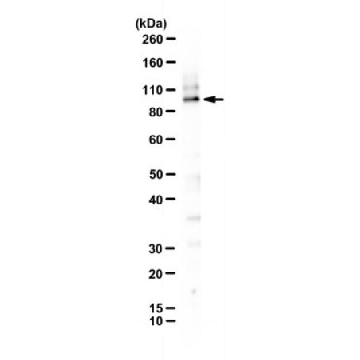 Anti-RHBDF2 Antibody, clone RHF2B 11H7，25MIG，MABS2314-25UG，Sigma