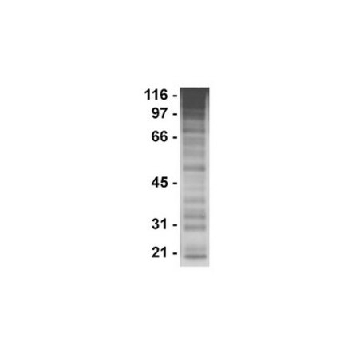 Anti-Phosphotyrosine Antibody, clone PY20，1MG，05-947，Sigma