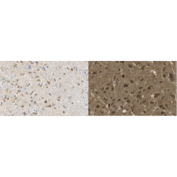 Anti-nonphospho-Ser9/21 GSK3β/α Antibody, clone 15C2，100UL，MABN2465，Sigma
