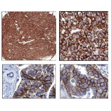 Anti-ROR2 Antibody, clone Nt 2535-2835，100UG，MABS1152，Sigma