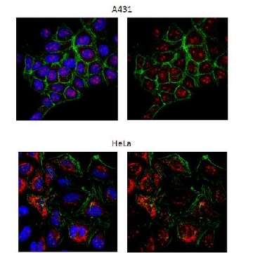抗-Rad51 (Ab-1) 兔pAb，100UL，PC130-100ULCN，Sigma
