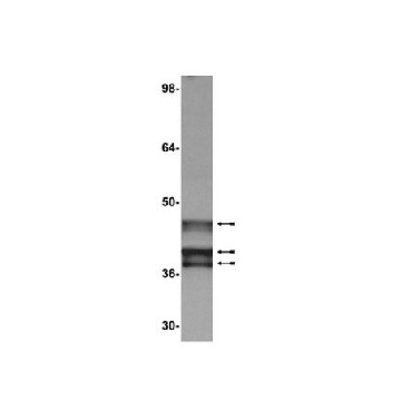 抗-E1A (Ad2/Ad5)抗体，克隆M73，100UG，05-599，Sigma