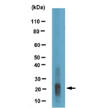 Anti-Amelogenin, X isoform/AMELX Antibody，100UL，ABT260，Sigma