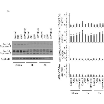 Anti-AUF1 Antibody，200UG，07-260，Sigma
