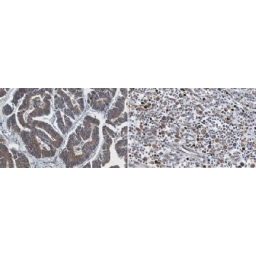 Anti-Nicotinic Acetylchone Receptor alpha 1 Antibody, clone 7C8.2，100UG，MABN1618，Sigma