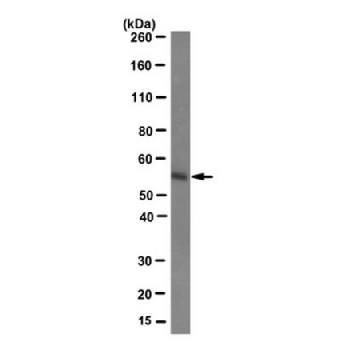 Anti-Estrogen Receptor β Antibody, clone 9.88，100UL，MABE290，Sigma