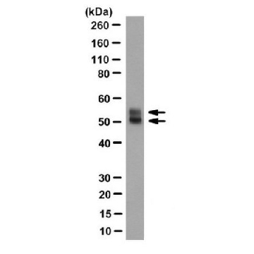 Anti-Herpes Simplex Virus Glycoprotein D Antibody, clone LP14，100UL，MABF1975，Sigma