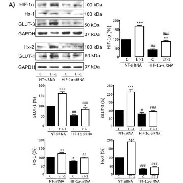 Anti-Glucose Transporter GLUT-3 Antibody, CT，50UL，AB1344，Sigma