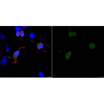 Anti-APP Antibody, clone 2B3，25UG，MABN852-25UG，Sigma
