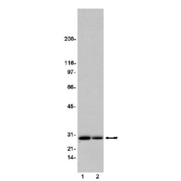 Ral Assay Reagent (Ral BP1, agarose)，300UG，14-415，Sigma