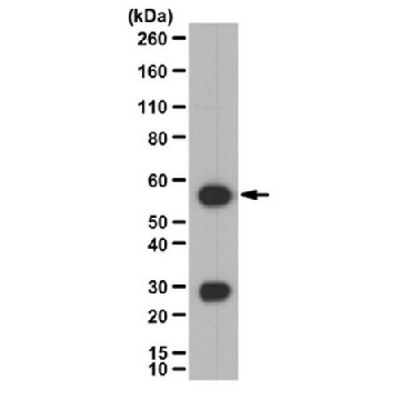 Anti-Calcineurin A/PP2B catalytic unit Antibody，100UG，07-068-I，Sigma