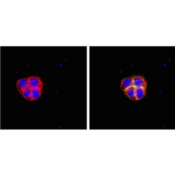 RIPAb+ Fragile X Mental Retardation Protein - RIP Validated Antibody and Primer Set，10ASSAYS，03-108，Sigma