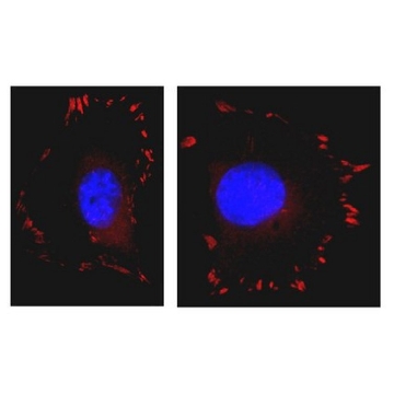 Anti-FAK Antibody, clone 4.47, Alexa Fluor™ 555 conjugate，100UG，16-234，Sigma