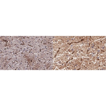 Anti-Aquaporin-4 Antibody, clone mECD，25UG，MABN2471-25UG，Sigma
