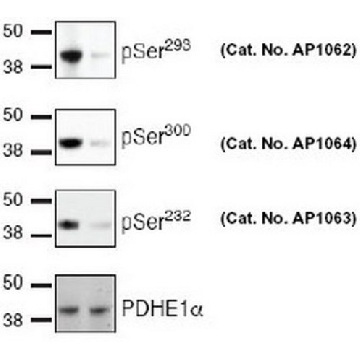 PhosphoDetect Anti-PDH-E1α (pSer²³²) Rabbit pAb，50UG，AP1063-50UGCN，Sigma