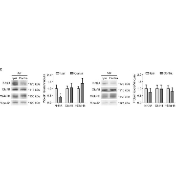 抗GluR1-NT（NT）抗体，克隆RH95，100UG，MAB2263，Sigma
