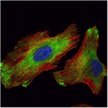 Anti-WIF1 Antibody, clone 1G5，100UL，MABN722，Sigma