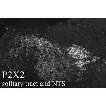 Anti-P2X2 Receptor Antibody，50UL，AB5894，Sigma