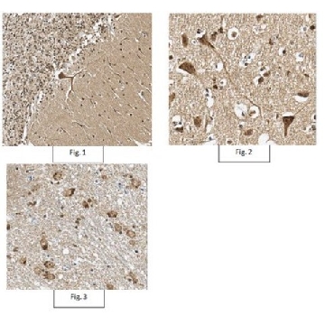 Anti-phospho PSD95 Antibody (Thr19)，100UG，ABN998，Sigma