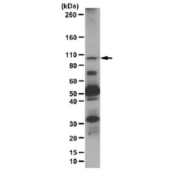 Anti-HMG-CoA reductase Antibody，100UG，ABS229，Sigma