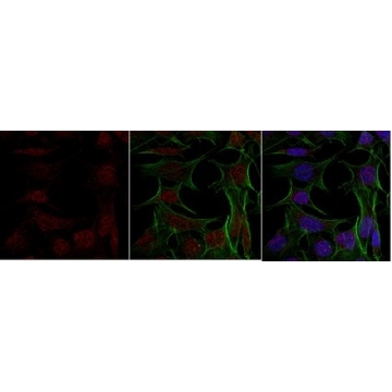 Anti-TFE3，100UG，ABE1400，Sigma