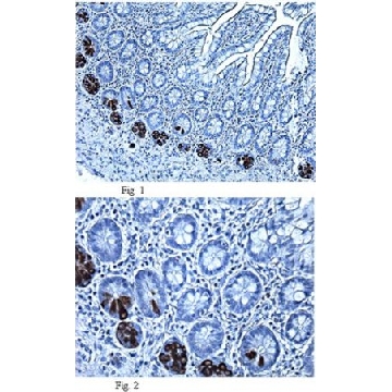 Anti-Alpha Defensin-5 (HD5) Antibody, clone 8C8，100UG，MABF31，Sigma