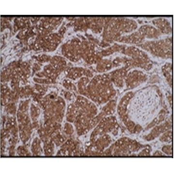 Anti-Alanyl-tRNA synthetase (AARS Antibody), clone M6-P2E5，100UG，MABN376，Sigma