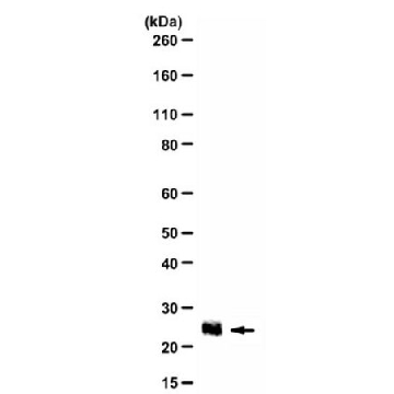 Anti-IGF2 Antibody，100UL，ABC504，Sigma