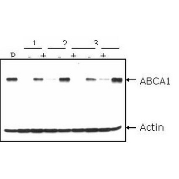 Anti-ABCA1 Antibody, clone AB.H10，100UG，MAB10005，Sigma