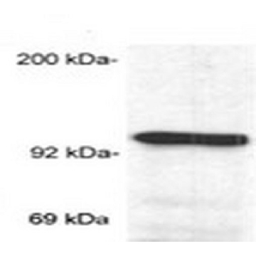 Anti-Glucocorticoid Receptor (Ab-2) Mouse mAb (BuGR2)，100UG，GR32L-100UGCN，Sigma