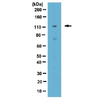 Anti-MuSK Antibody，100UL，ABS549，Sigma
