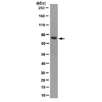 Anti-TrpV6 Antibody, clone 4A5.1，100UL，MABN839，Sigma