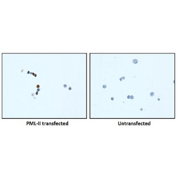 Anti-PML Isoform II Antibody, clone 1A8.1，100UG，MABE175，Sigma