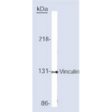 抗纽蛋白小鼠mAb（V284或VLN01），100UG，CP74-100UGCN，Sigma