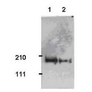 Anti-Tiam1 Rabbit pAb，50UG，ST1070-50UGCN，Sigma